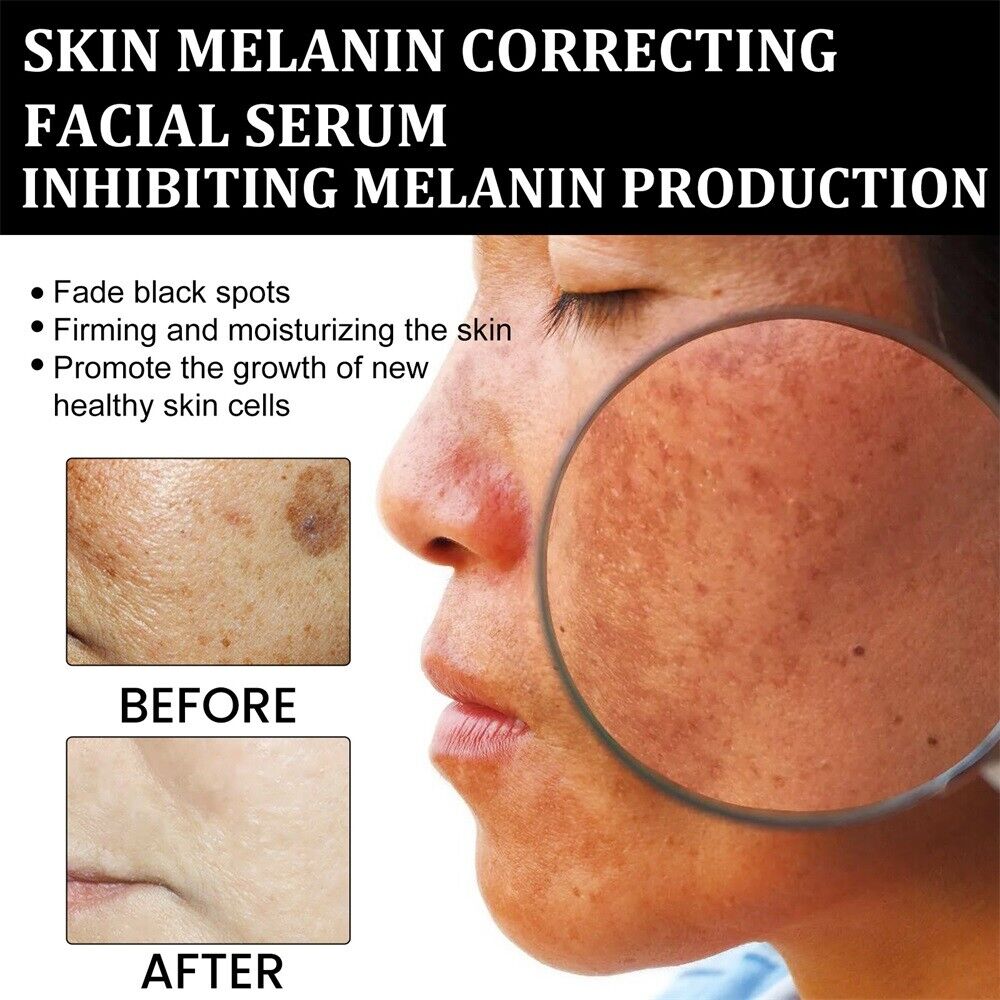 ✨KLENIMORE™ Niacinamide Brightening Serum